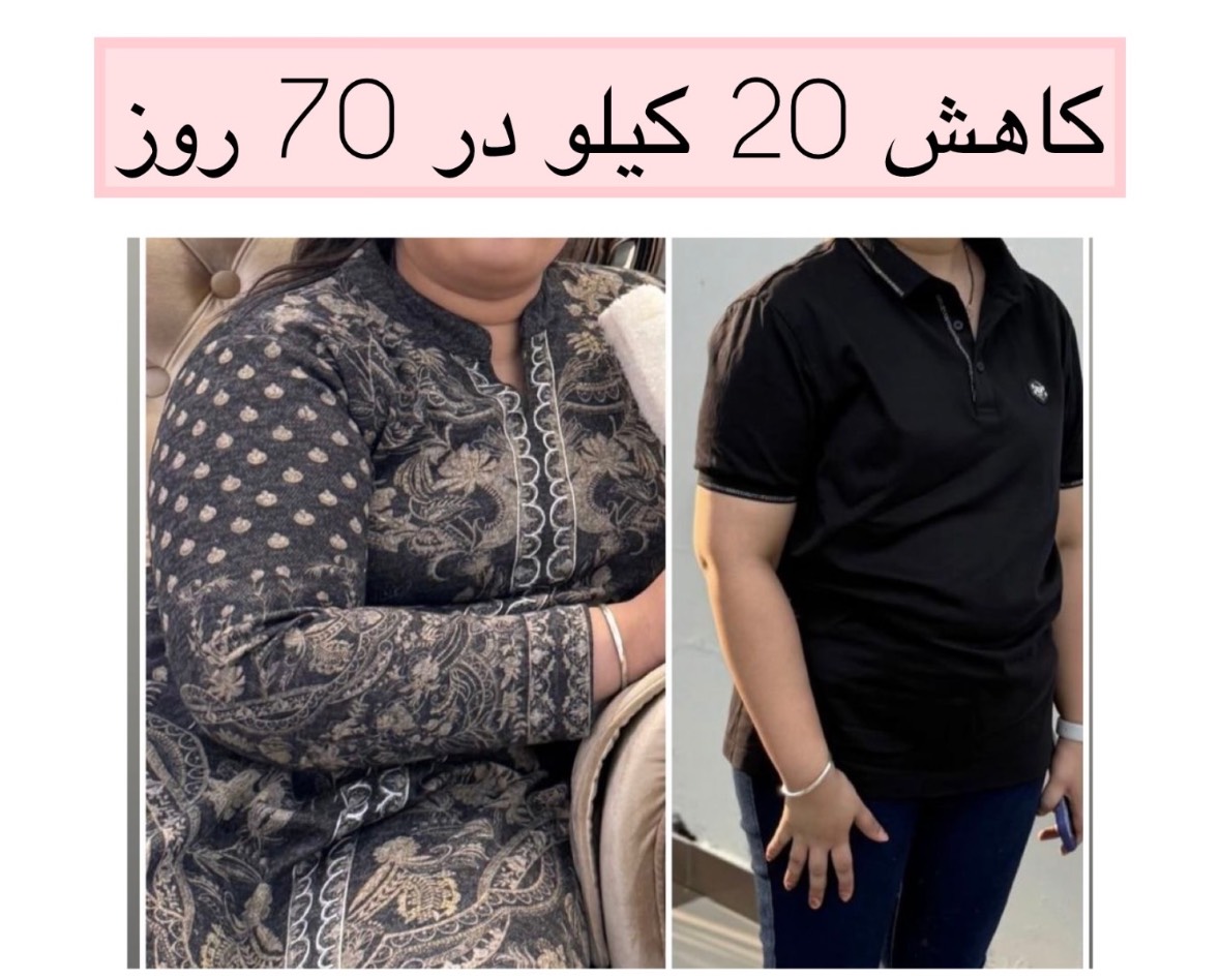 کلینیک لاغری زیبایی دکتر رشیدبیگی — تصویر ۱