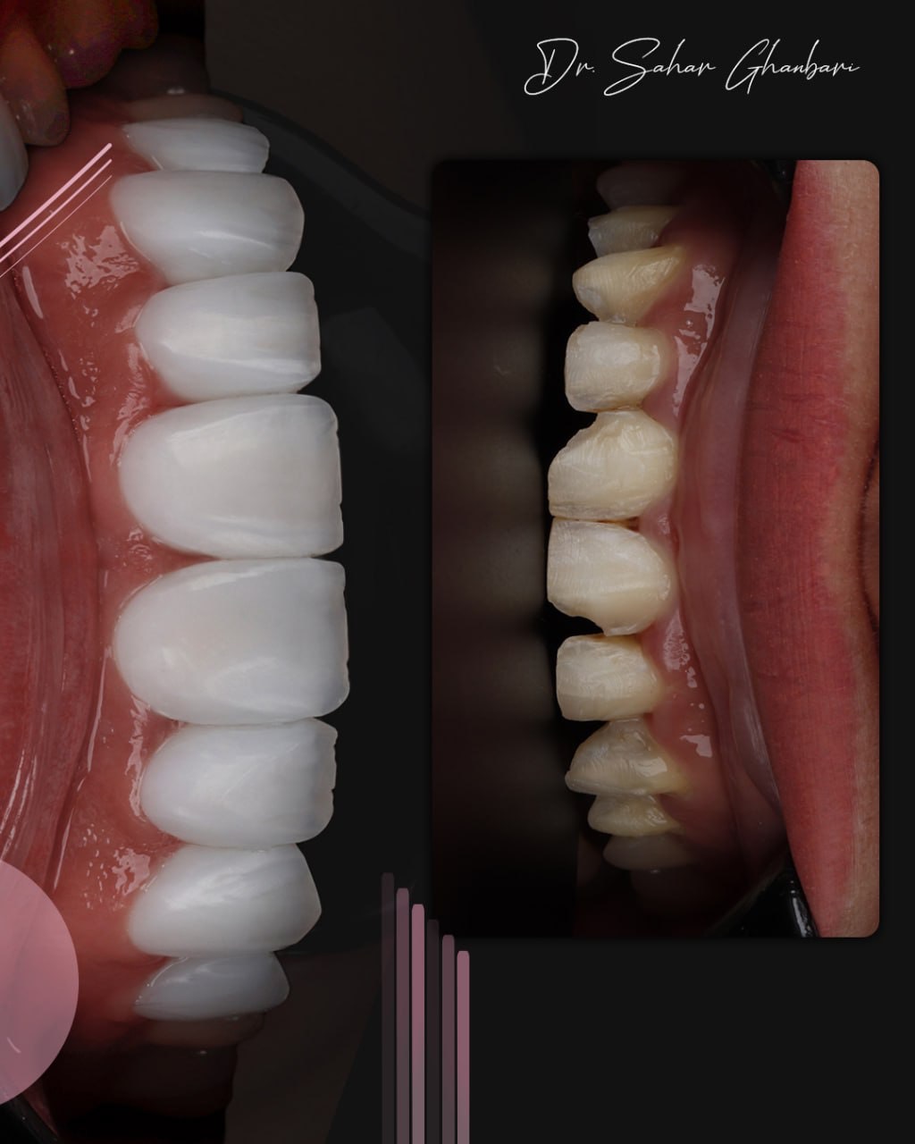 کلینیک دندانپزشکی دکتر سحر قنبری — تصویر ۳