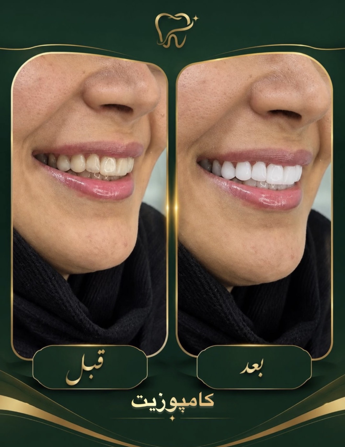 کلینیک دندانپزشکی مبین — تصویر ۳