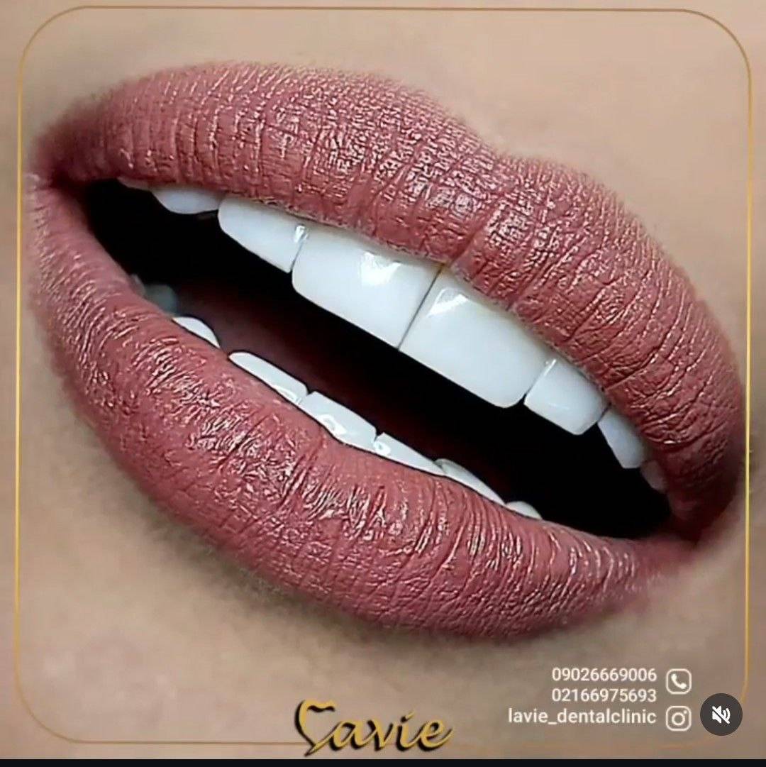 مرکز دندانپزشکی لاویه — تصویر ۵