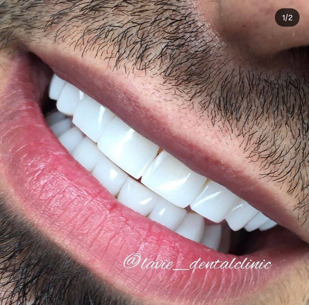 مرکز دندانپزشکی لاویه — تصویر ۲