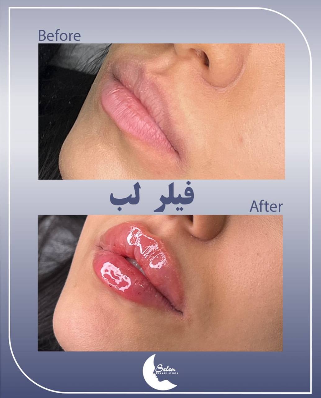 کلینیک زیبایی سلن — تصویر ۳