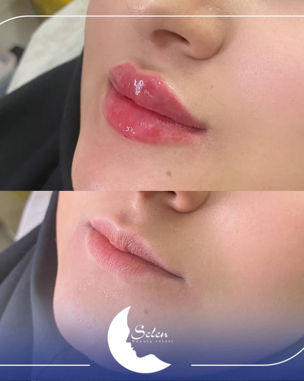 کلینیک زیبایی سلن — تصویر ۴
