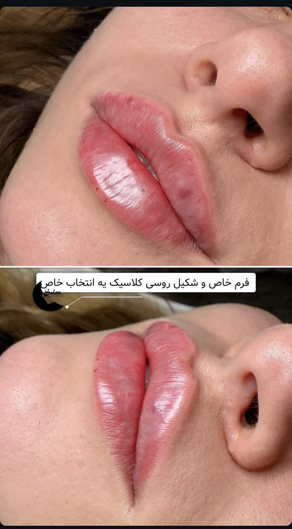 کلینیک زیبایی سلن — تصویر ۴