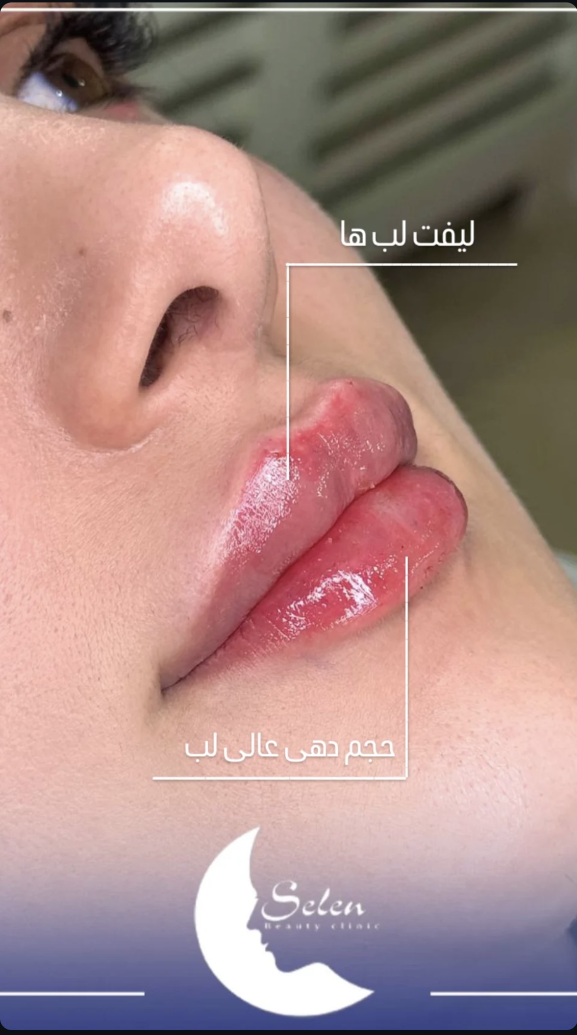 کلینیک زیبایی سلن — تصویر ۵