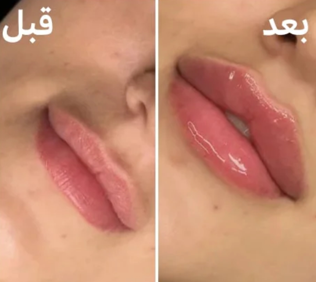 کلنیک تخصصی پوست و مو تناسب اندام Lovely — تصویر ۱