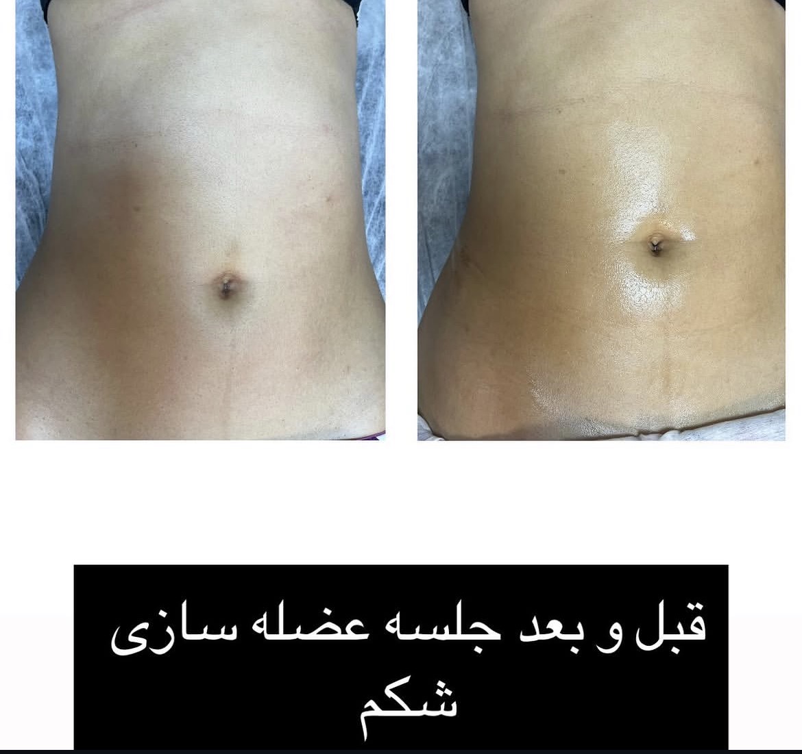 کلنیک تخصصی پوست و مو تناسب اندام Lovely — تصویر ۵